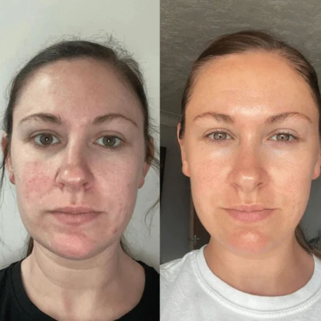 DewCell™ Collagen Veil